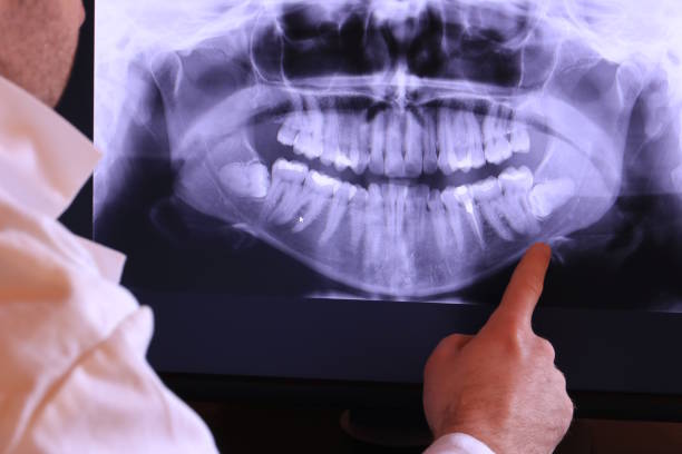 Best Chipped Tooth Repair Near Me  in Groton, SD